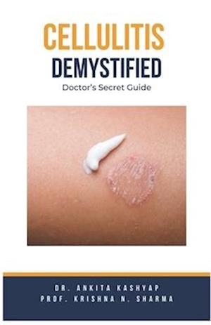 Cellulitis Demystified: Doctor's Secret Guide