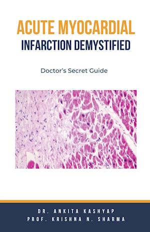 Acute Myocardial Infarction Demystified