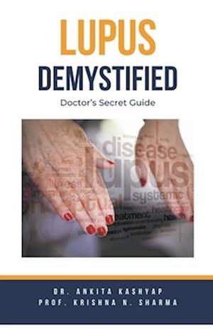 Lupus Demystified: Doctor's Secret Guide