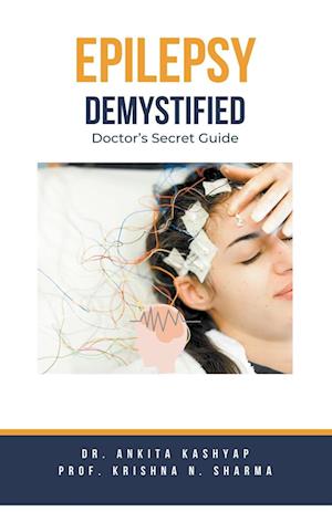 Epilepsy Demystified