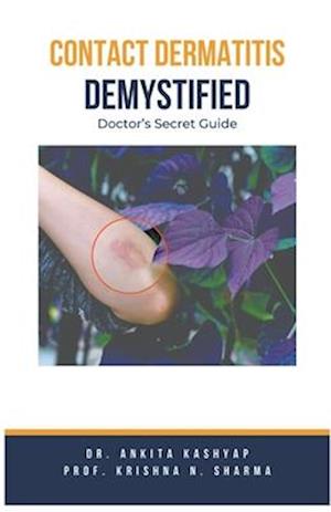 Contact Dermatitis Demystified: Doctor's Secret Guide