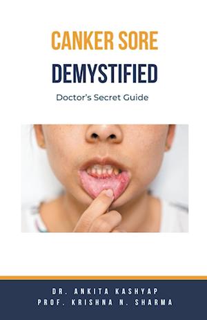 Canker Sore Demystified