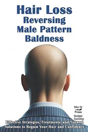 Hair Loss-Rversing Male Pattern Baldness