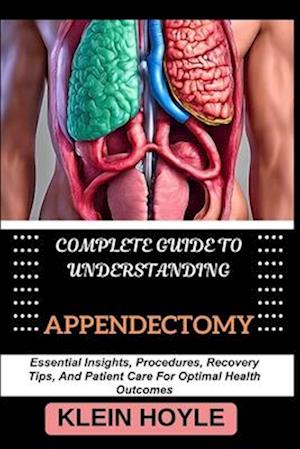 Complete Guide to Understanding Appendectomy