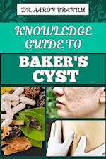 Knowledge Guide to Baker's Cyst