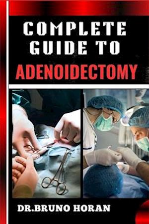 Complete Guide to Adenoidectomy