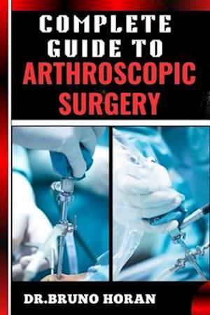 Complete Guide to Arthroscopic Surgery