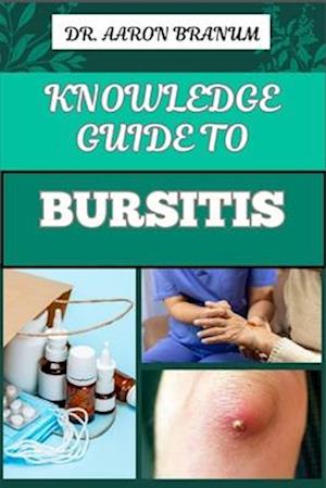 Knowledge Guide to Bursitis