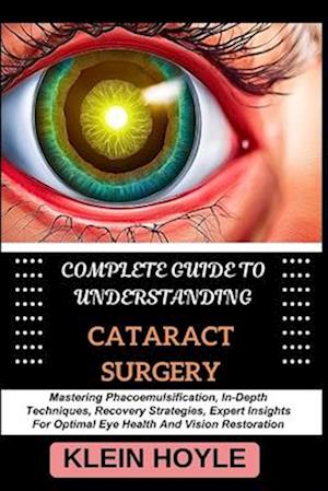 Complete Guide to Understanding Cataract Surgery