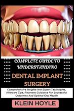 Complete Guide to Understanding Dental Implant Surgery
