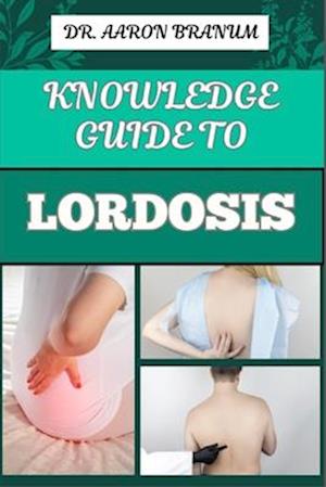 Knowledge Guide to Lordosis