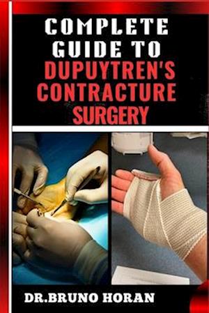 Complete Guide to Dupuytren's Contracture Surgery