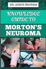 Knowledge Guide to Morton's Neuroma