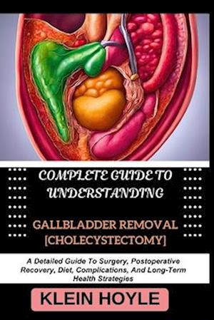 Complete Guide to Understanding Gallbladder Removal [Cholecystectomy]