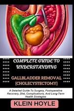 Complete Guide to Understanding Gallbladder Removal [Cholecystectomy]