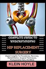 Complete Guide to Understanding Hip Replacement Surgery