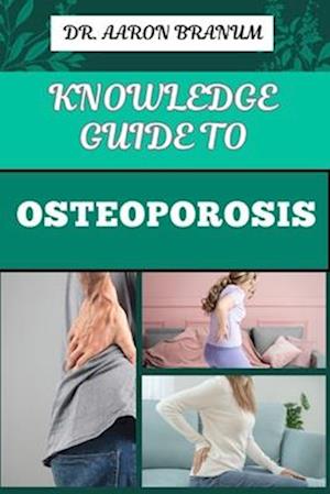 Knowledge Guide to Osteoporosis