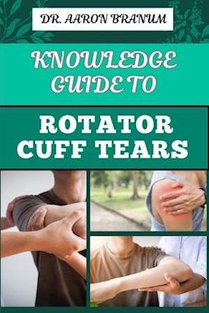 Knowledge Guide to Rotator Cuff Tears