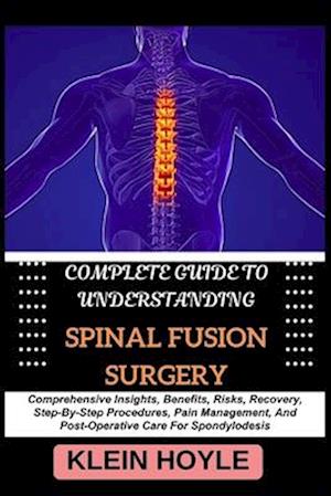 Complete Guide to Understanding Spinal Fusion Surgery