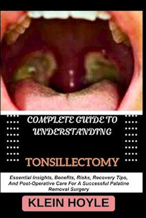 Complete Guide to Understanding Tonsillectomy