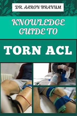 Knowledge Guide to Torn ACL