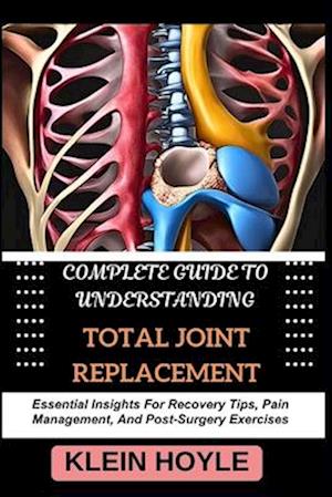 Complete Guide to Understanding Total Joint Replacement