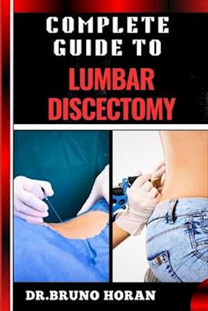 Complete Guide to Lumbar Discectomy