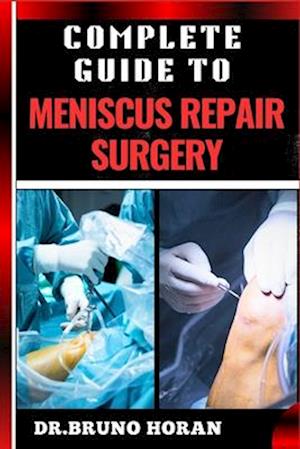 Complete Guide to Meniscus Repair Surgery