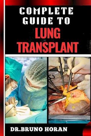 Complete Guide to Lung Transplant