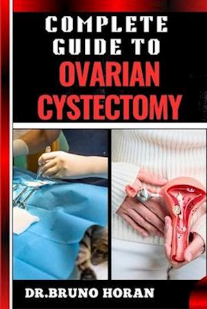 Complete Guide to Ovarian Cystectomy