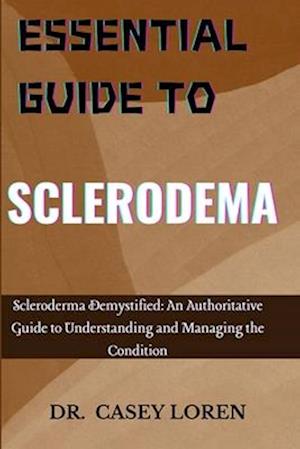 Essential Guide to Sclerodema