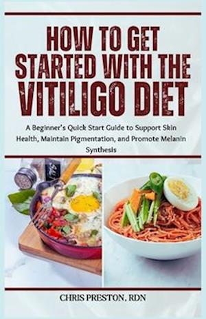 How to Get Started with the Vitiligo Diet