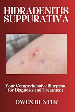 Hidradenitis Suppurativa