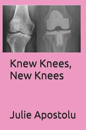 Knew Knees, New Knees