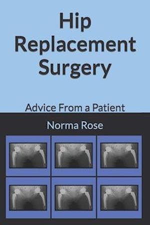 Hip Replacement Surgery : Advice From a Patient