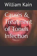 Causes & Treatment of Tonsils Infection 