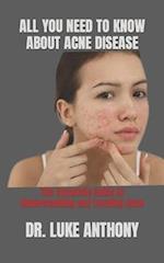 ALL YOU NEED TO KNOW ABOUT ACNE DISEASE : The Complete Guide to Understanding and Treating Acne 