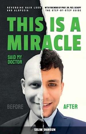 THIS IS A MIRACLE SAID MY DOCTOR: REVERSING HAIR LOSS AND ALOPECIA