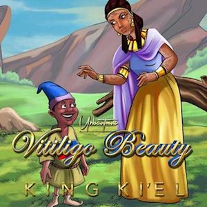 Vitiligo Beauty: A Retelling of Snow White