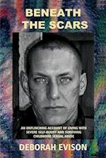 BENEATH THE SCARS: An unflinching account of living with severe self-injury and surviving childhood sexual abuse 