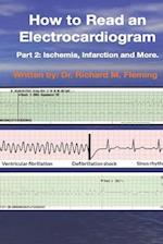 How to Read an Electrocardiogram