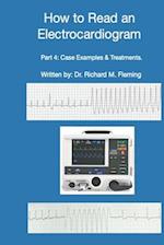 How to Read an Electrocardiogram - Part 4