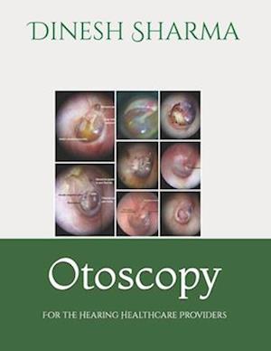 Otoscopy: For the Hearing Healthcare Provider