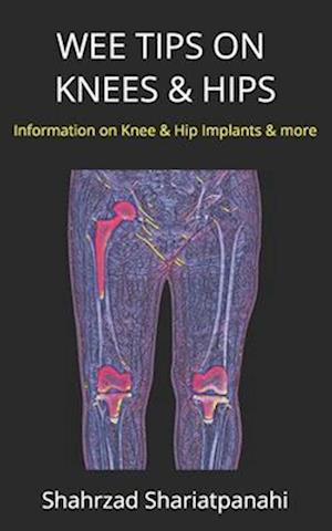 WEE TIPS ON KNEES & HIPS: Information on Knee & Hip Implants and More