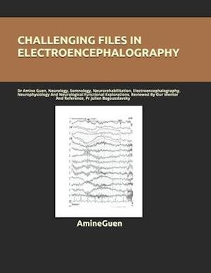 Challenging Files in Electroencephalography