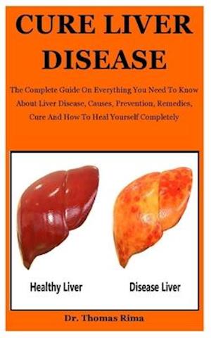 Cure Liver Disease: The Complete Guide On Everything You Need To Know About Liver Disease, Causes, Prevention, Remedies, Cure And How To Heal Yourself