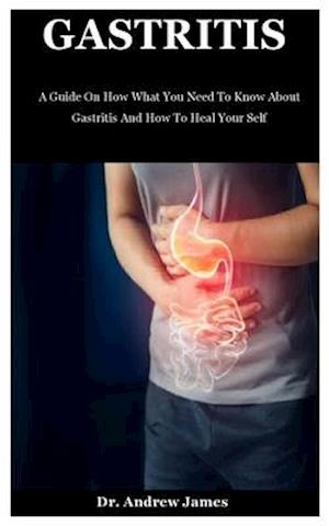 Gastritis: A Guide On How What You Need To Know About Gastritis And How To Heal Your Self