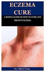 Eczema Cure: A SIMPLE GUIDE ON HOW TO CURE AND PREVENT ECZEMA 