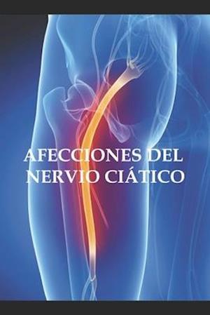 Afecciones del nervio ciático