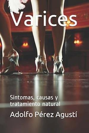 Varices